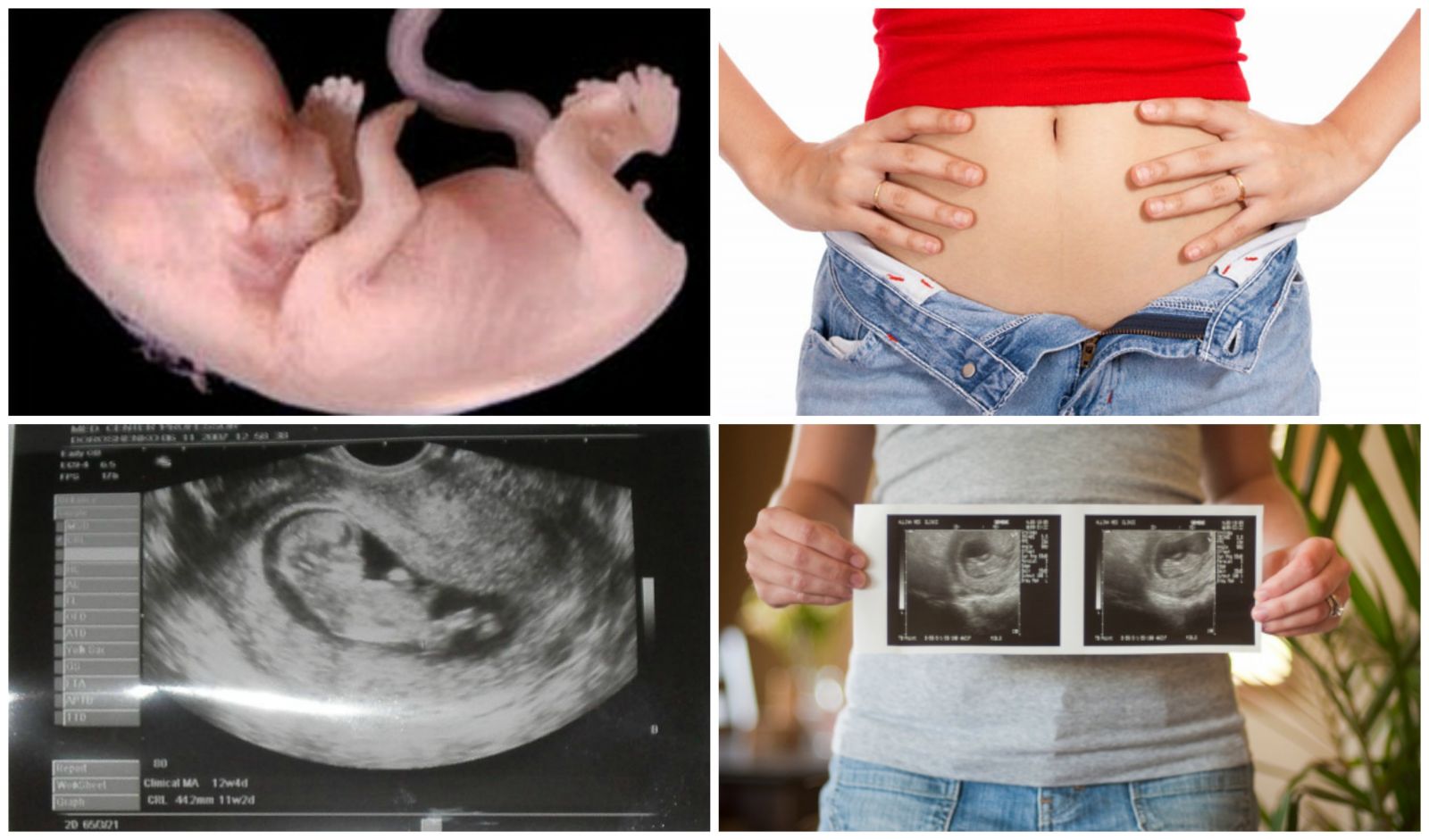 11 неделя 3 дня. Малыш на 11 неделе беременности скрининг. УЗИ на 11 неделе беременности скрининг. УЗИ плода на 11 неделе беременности. УЗИ малыша 11 недель.