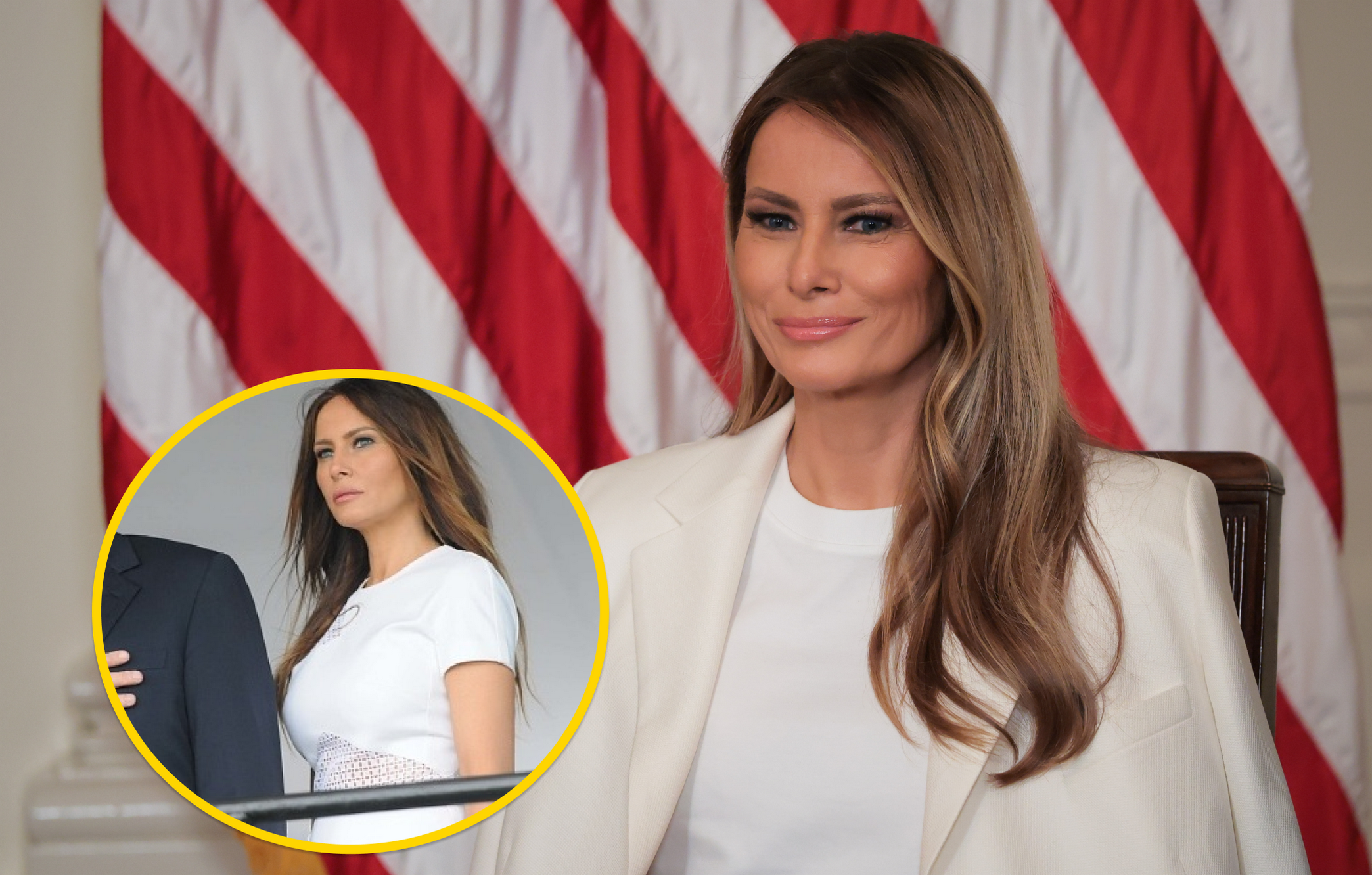 Секрети зовнішності Меланії Трамп. Як змінювалася перша леді США і чи робила пластику