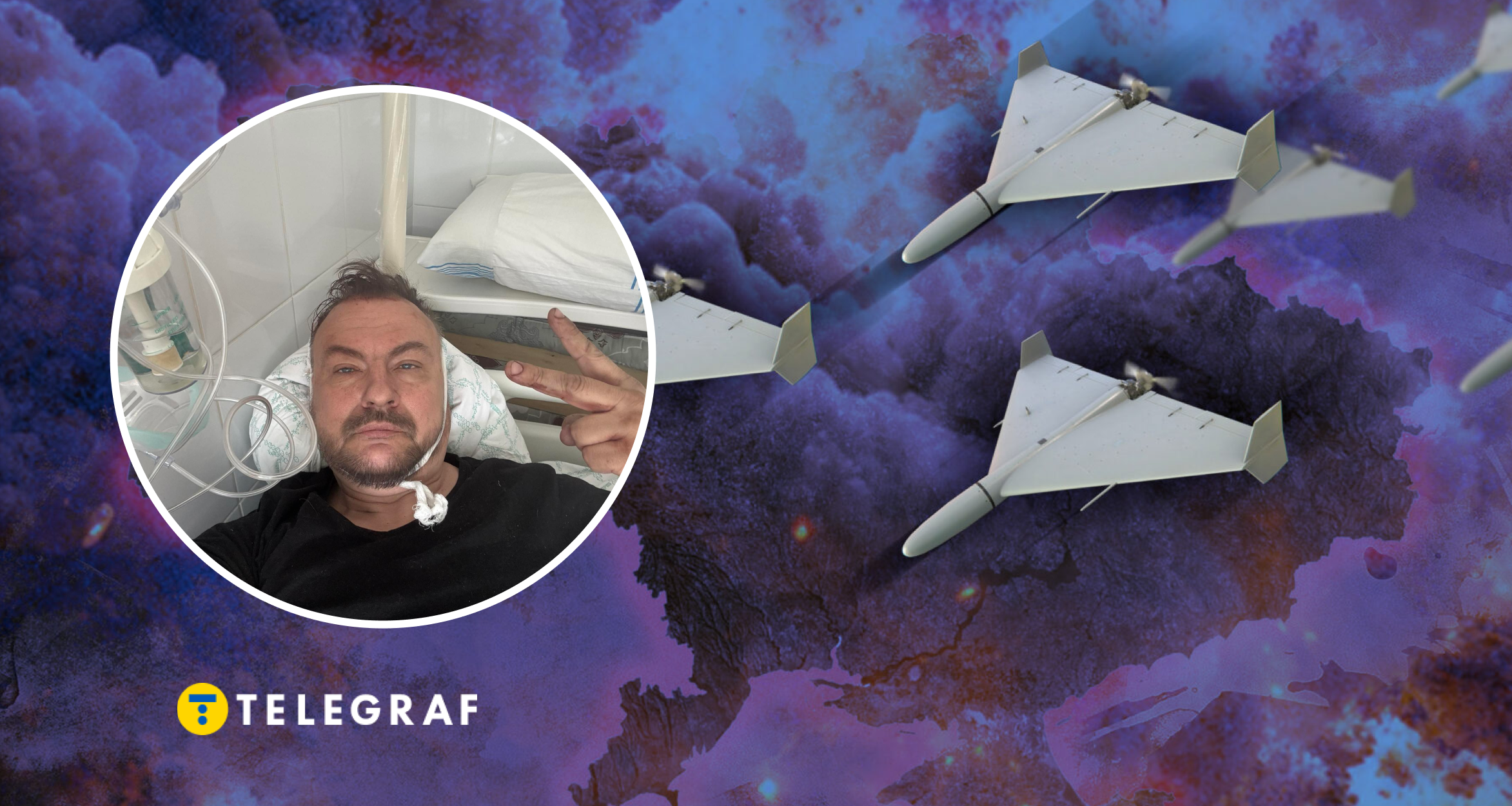 Росіяни скоїли напад на радника міністра оборони: в якому він стані зараз