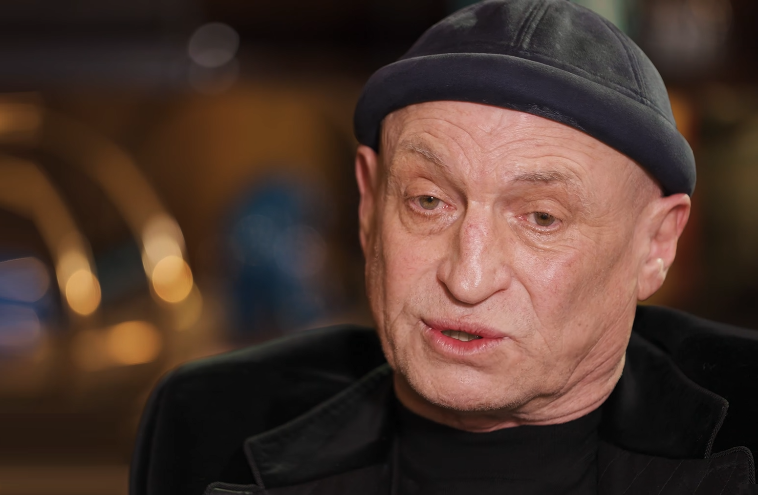 Не для краси: чоловік Полякової Вадік зізнався, чому носить шапку (відео)