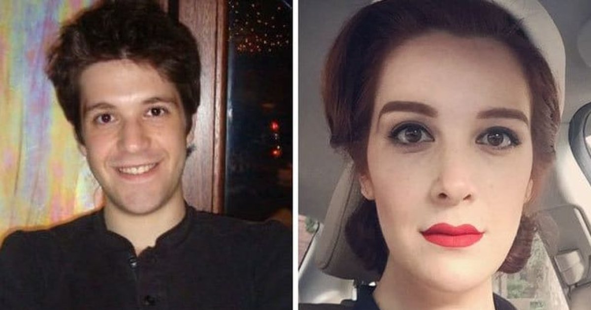 Операция трансгендеров фото. Смена пола. Из мужчины в женщину. Смена пола до и после. Транчгейдкри до и после.