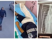 Після зіткнення у дитини перелом ноги