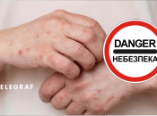 Днепропетровщину атакуют мокрецы