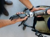 За протезом не обязательно ехать за границу