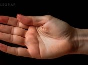 Народні вірування здавна пов'язували знаки тіла, як вісточку про майбутнє