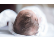 Почему у ребенка выпадают волосы