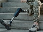 Військові мають право на безкоштовне протезування