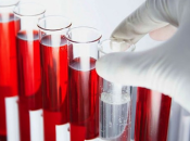 Как расшифровать показатели общего анализа крови у взрослых