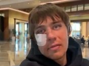 Проснулся - и получил в глаз: появилось видео с побитым российским футболистом