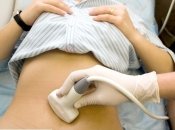 Мнение врача: 4 вопроса про УЗИ во время беременности