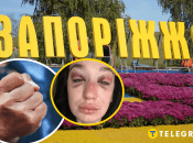 Постражлала дівчина