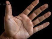 Кількість прикмет про сверблячку дуже велика