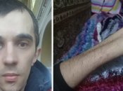 Нема руки й ока, але військкомат про нього не забув: чому жителя Сумщини призивають вже вдруге