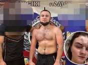 Боец ММА сломал нос жене в Омске