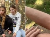 Дочери Поляковой Алиса и Мария, а также нога Алисы