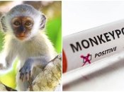 Обезьянью оспу зафиксировали в 11 странах мира