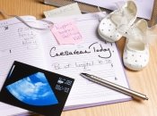 8 неожиданных последствий кесарева сечения