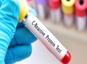 В лабораториях цена на этот вид диагностики вполне приемлема: от 70 грн