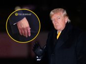 Дональд Трамп знову ховає синці на руках