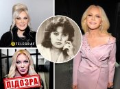 Таисия Повалий не скрывает, что делает пластику и "уколы красоты"