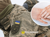 Непридатний до служби