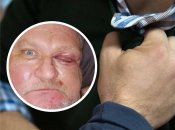 Депутата від "ЄС" Ігоря Осауленка побили у Херсоні