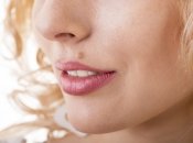 Родимка на обличчі