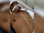 Індус прокинувся в морзі після семи годин як його приписали до померлих