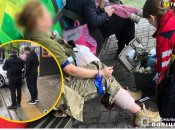 Женщина получила травму ноги