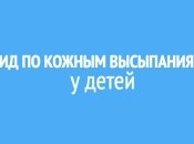 Сыпь у ребенка: фото с пояснениями