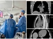 Операцию проводили столичные медики