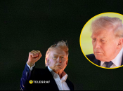 Дональд Трамп начал стремительно терять волосы