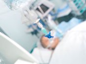 Иллюстративное изображение