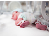 Что может вызвать преждевременные роды: 10 основных причин