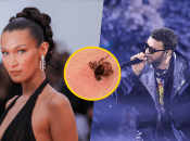 Белла Хадид и Джастин Тимберлейк борются с болезнью Лайма