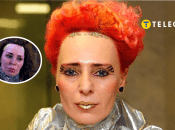 Жанна Агузарова до и после пластики