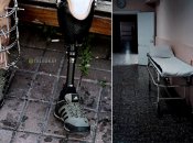 Пакеты с конечностями, кладбища и крематории: как в Украине утилизируют ампутированные руки и ноги тяжелых "300-х" (фото)