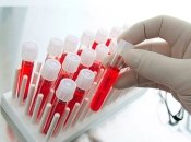 ОАК - обязательный анализ при ковиде