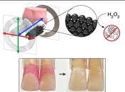 Наночастицы чистят зубы