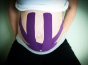 Кинезиотейпирование: может ли лента заменить бандаж для беременных