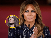 Мелания Трамп до и после пластики