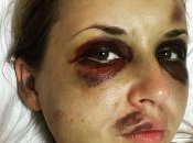 Нападение в поезде: у потерпевшей ухудшилось здоровья, а сотрудников поезда уволят 