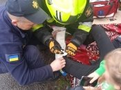 Рятувальники надали першу допомогу потерпілій дівчинці