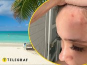 Стан здоров'я дівчини різко погіршився