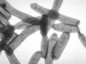 Бактерії легіонели