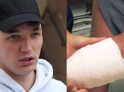 Едвард Білл отримав серйозне захворювання