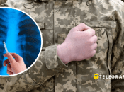 Військова служба з обмеженням