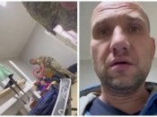 Потерпілий показав сліди після побиття на своєму тілі