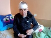 Избитый военный Анатолий Грищук