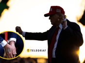 Разговоры о гематомах Трампа не утихают